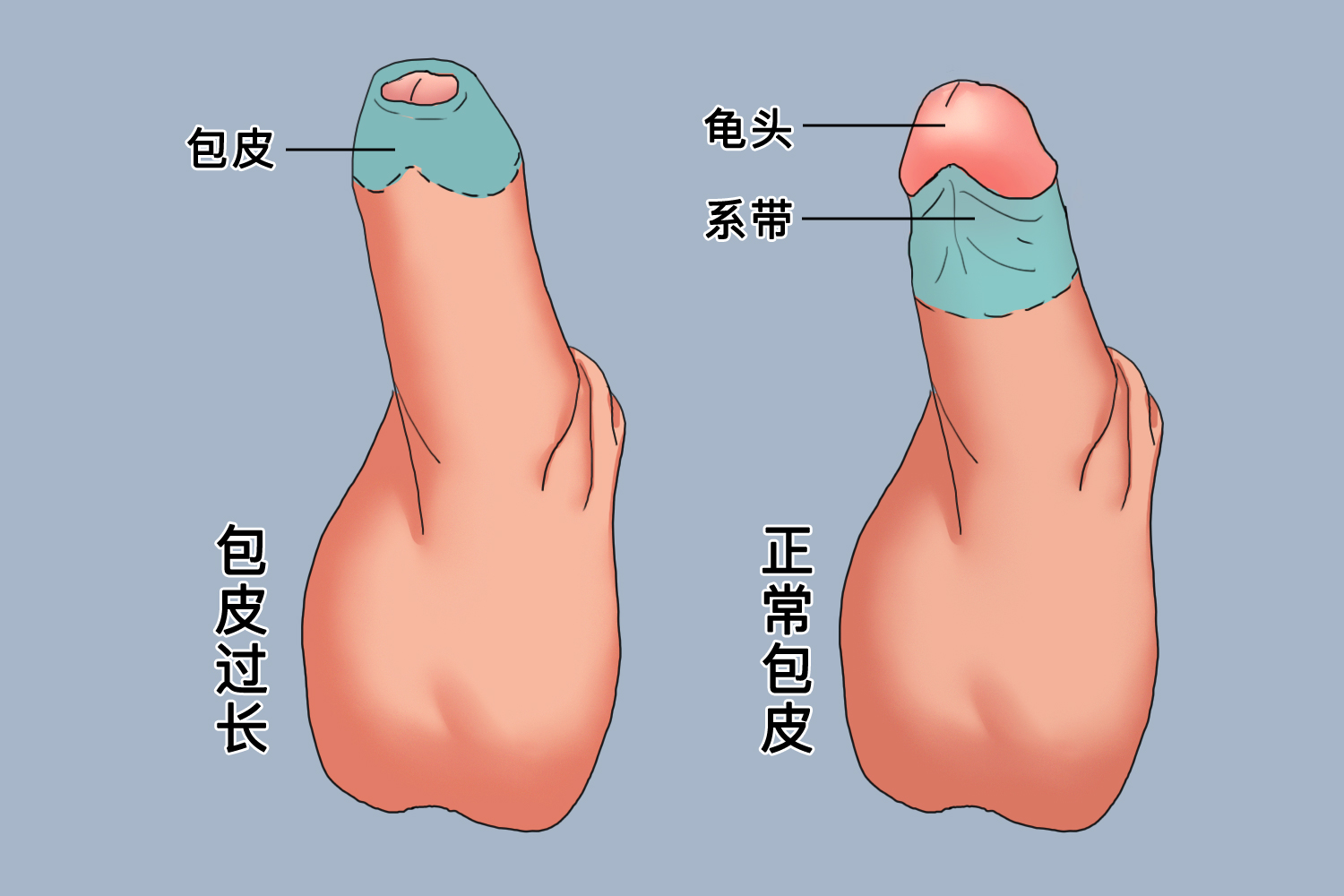 探索男性生理奧秘，包皮的正常形態(tài)解析，男性生理奧秘探索，包皮正常形態(tài)解析