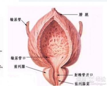 治療前列腺炎的最佳方法，治療前列腺炎的最佳方法解析