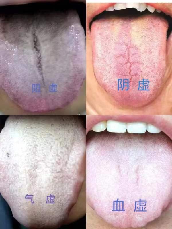 男性腎陽虛的癥狀及其影響，男性腎陽虛癥狀與影響概述